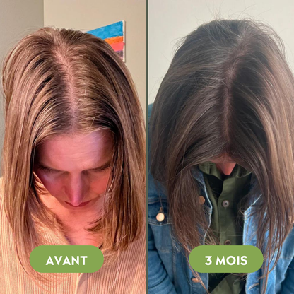 Serum na porost włosów (60 ml)