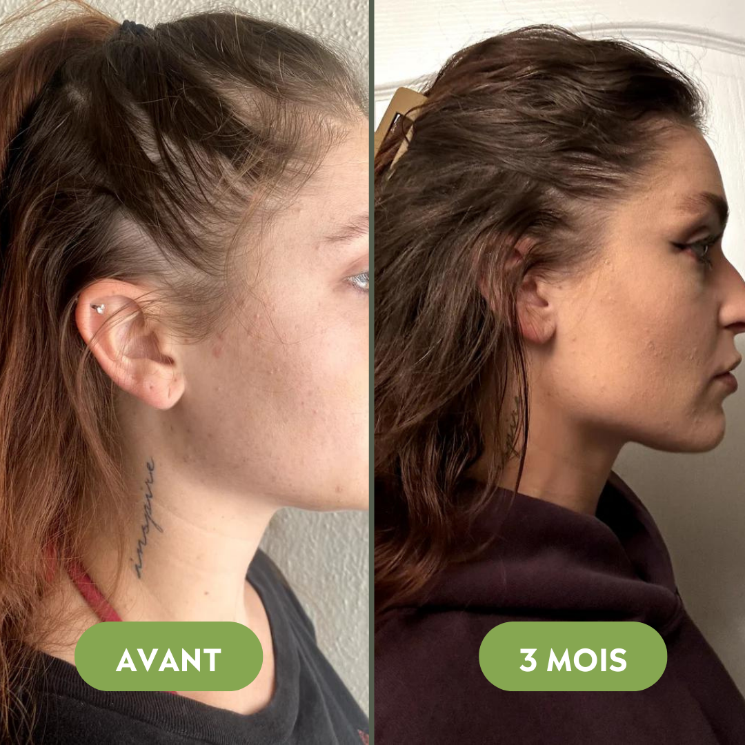 Serum na porost włosów (60 ml)