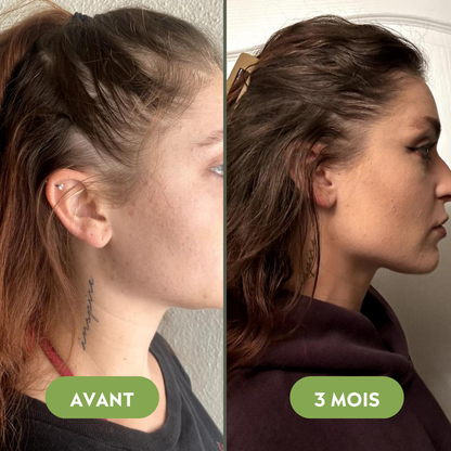 Serum na porost włosów (60 ml)