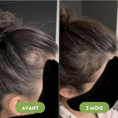 Serum na porost włosów (60 ml)