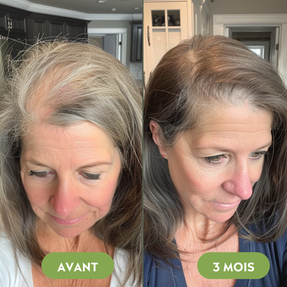 Serum na porost włosów (60 ml)