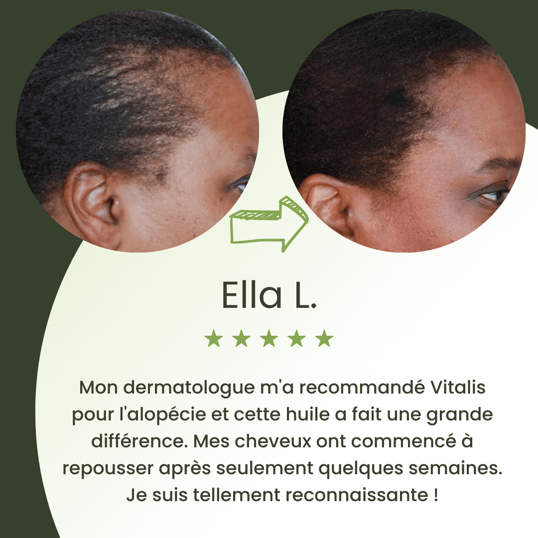 Serum na porost włosów (60 ml)