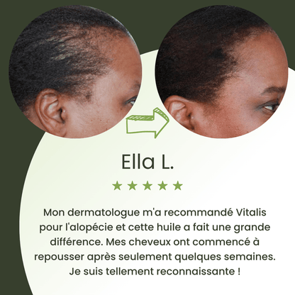 Serum na porost włosów (60 ml)