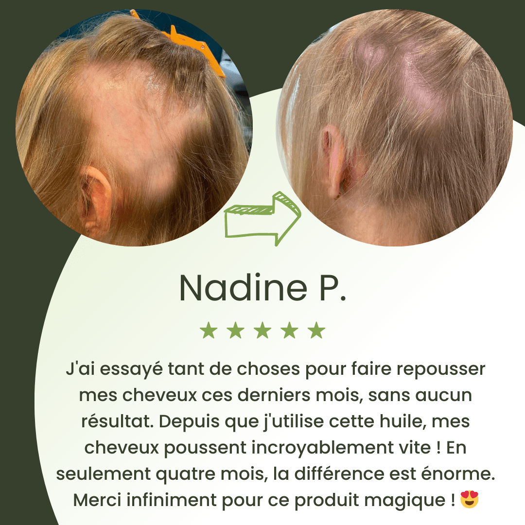 Serum na porost włosów (60 ml)