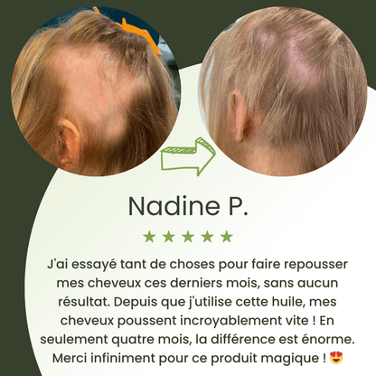 Serum na porost włosów (60 ml)